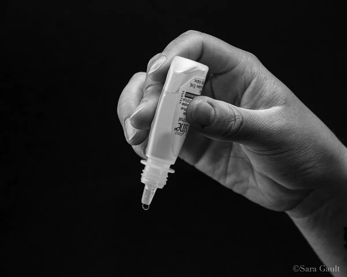Instillazione di lacrime artificiali, trattamento della secchezza oculare