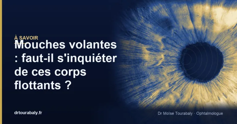 Mouches volantes : faut-il s'inquiéter de ces corps flottants ?