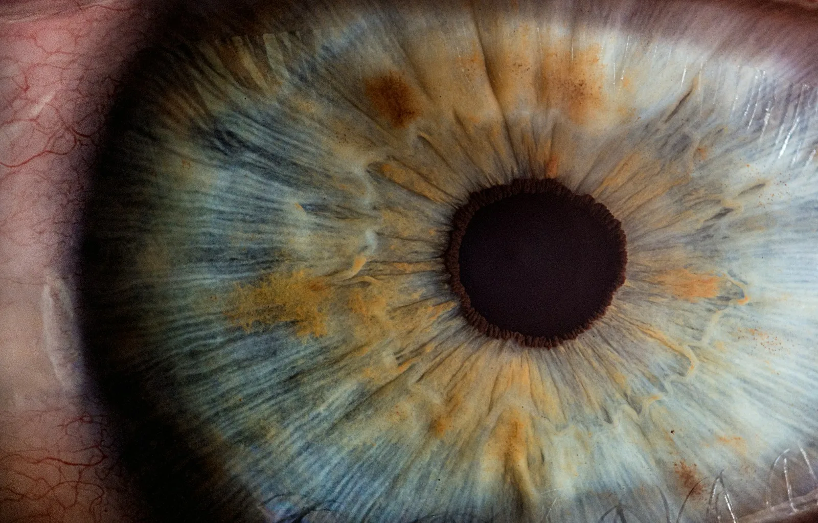 Gros plan macro d'un iris humain, illustrant l'analyse de la cornée avant une chirurgie réfractive