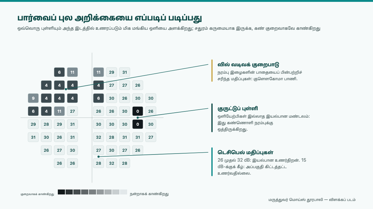 விழித்திரை உணர்திறன் வரைபடத்தைக் காட்டும் பார்வைப் புலப் பரிசோதனையின் அச்சிடப்பட்ட அறிக்கை